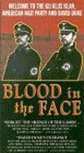 Blood in the Face pictures.